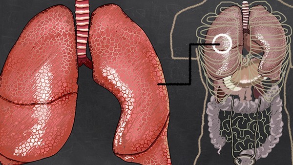 肺癌早期的症状有哪些 中医四大