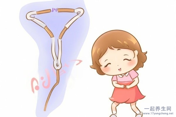 结扎对女人有什么伤害 结扎对女